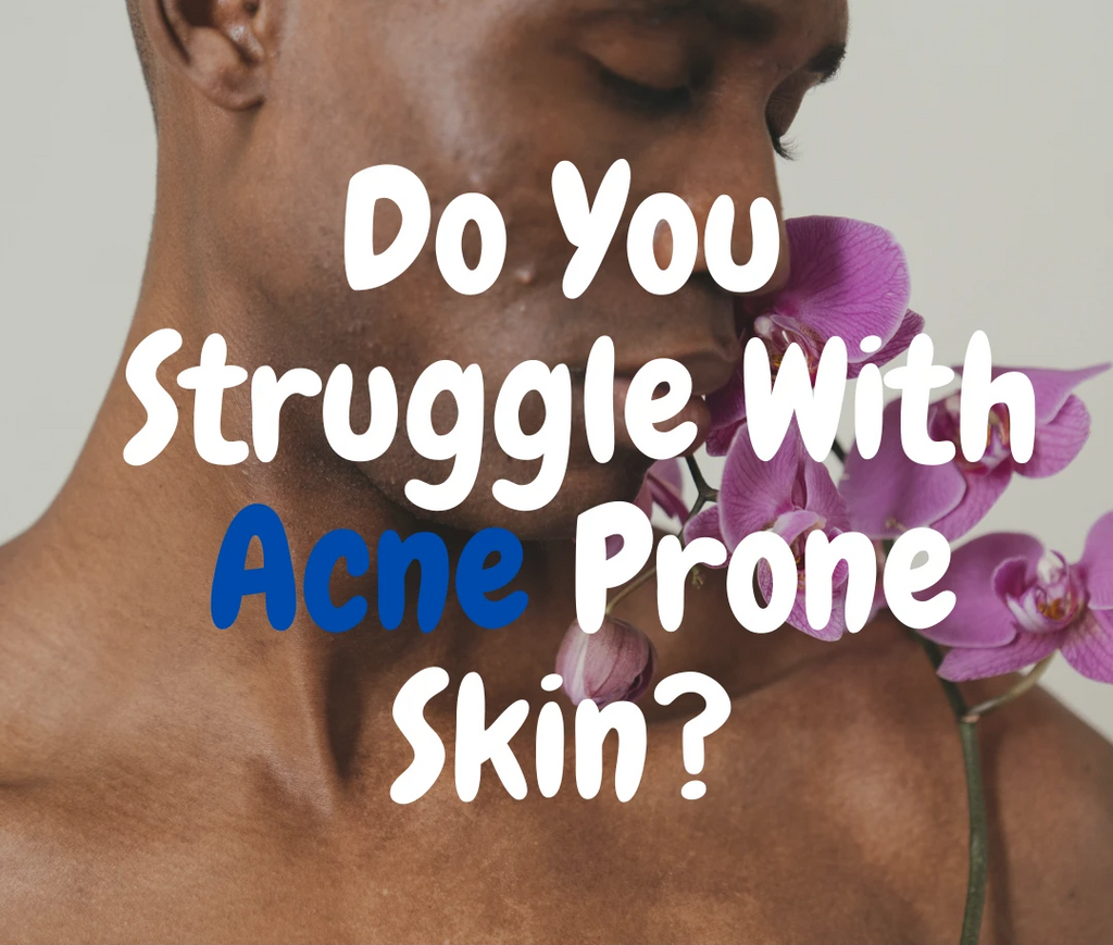 Do You Struggle With Acne Prone Skin?